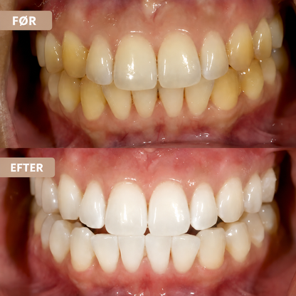 Whitening Tandpasta – Reducerer misfarvninger
